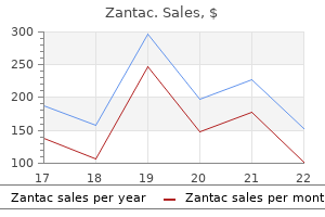 generic zantac 150mg fast delivery